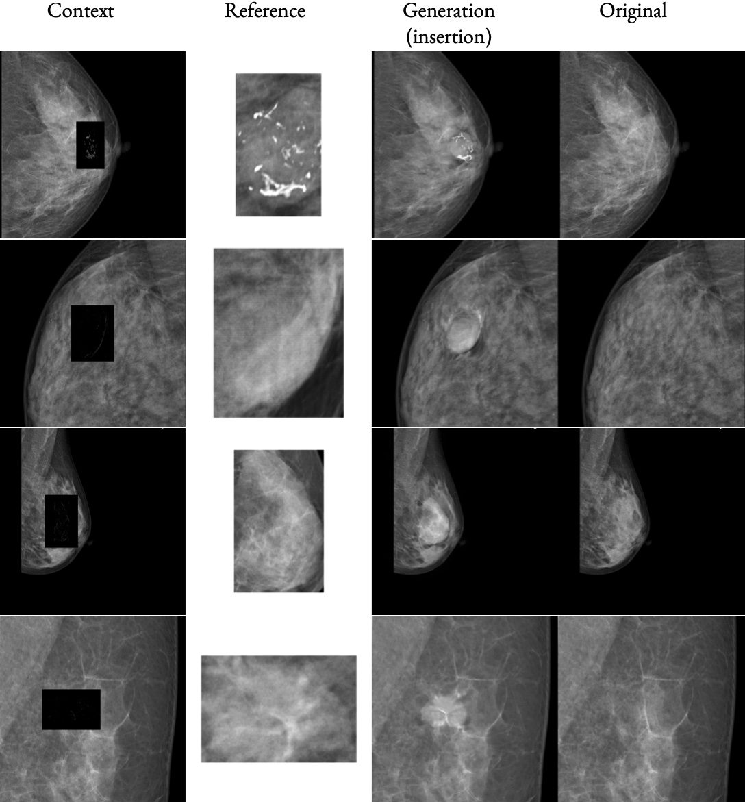 AnydoorMed insertion results