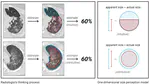 Evidence of a cognitive bias in the quantification of COVID-19 with CT: an artificial intelligence randomised clinical trial