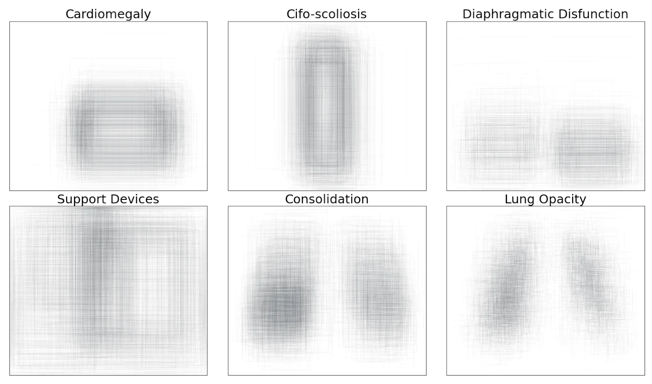 Figure from “Revised Set Prediction Matching for Chest X-ray Pathology Detection with Transformers”