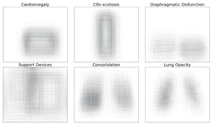 Figure from “Revised Set Prediction Matching for Chest X-ray Pathology Detection with Transformers”